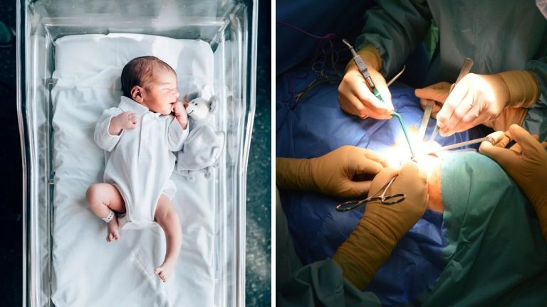 Temná kapitola medicíny: Keď lekári operovali novorodencov bez anestézie!