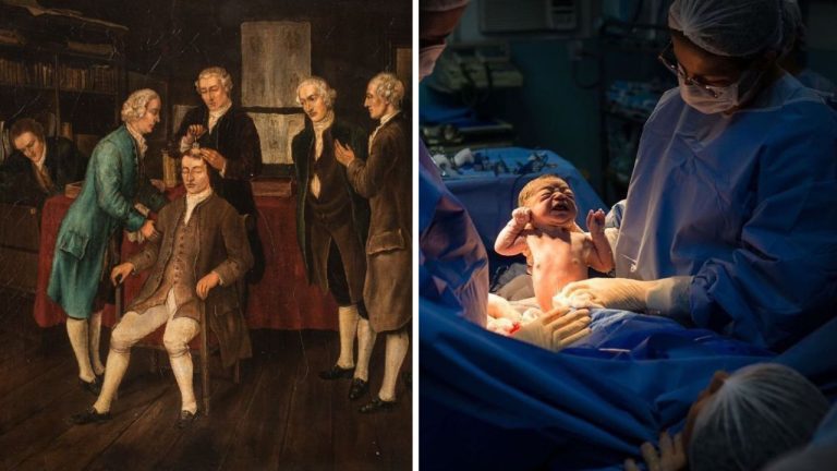 10 bežných operácií, ktorých história je oveľa napínavejšia, než by ste čakali