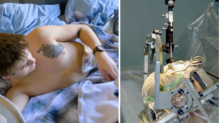 10 šokujúcich chirurgických zákrokov, ktoré prekročili všetky hranice