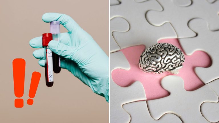 Prelom vo výskume: Alzheimerovu chorobu môže odhaliť krvný test roky vopred, ešte pred prvými príznakmi