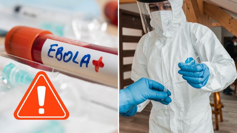 Svetová zdravotnícka organizácia vyhlásila pre ebolu mimoriadny stav. Nebezpečný vírus sa šíri Afrikou