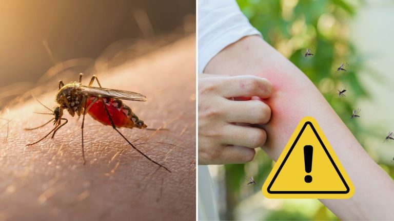 Nie je to krvná skupina. Vedci odhalili, prečo komáre štípu niektorých ľudí viac než ostatných