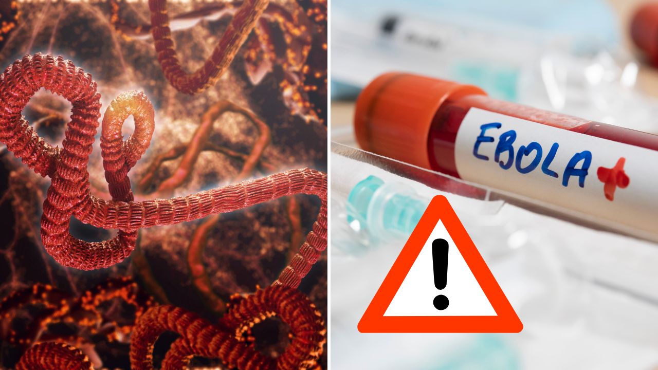 Ebola sa objavila v Európe. Prvý prípad mimo Afriky vyvolal zvýšené bezpečnostné opatrenia