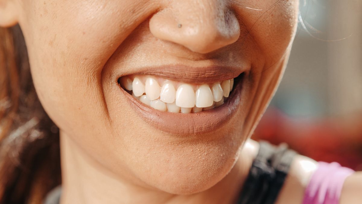 A close-up of a woman's smile, showcasing healthy teeth and natural skin tone.