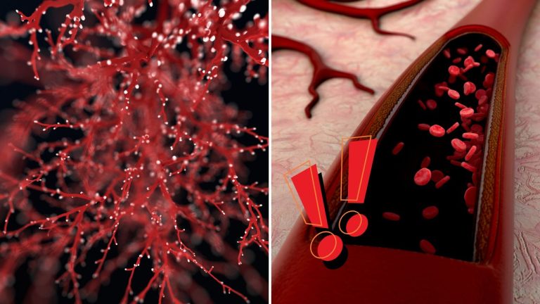 Vedci našli nový spôsob, ako vytvárať umelé cievy. Môže to zmeniť budúcnosť transplantácií