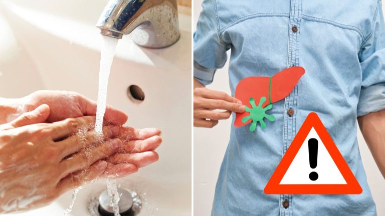 Žltačka opäť trápi Slovensko. Nové prípady hlásia z viacerých častí krajiny