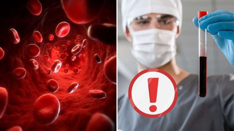 Vedci vyriešili 50-ročnú záhadu ľudskej krvi. Objav viedol k určeniu nového krvnoskupinového systému